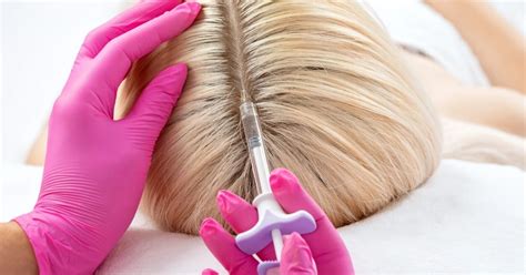 prp tedavisinin saça faydaları